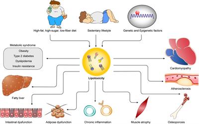 Lipotoxicity as a therapeutic target in obesity and diabetic cardiomyopathy